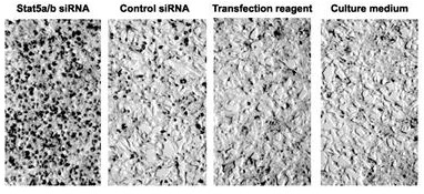 transfection with Stat5a siRNA.jpg